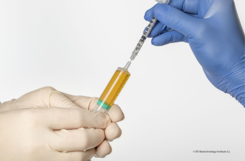 膝関節にPRGFを注入