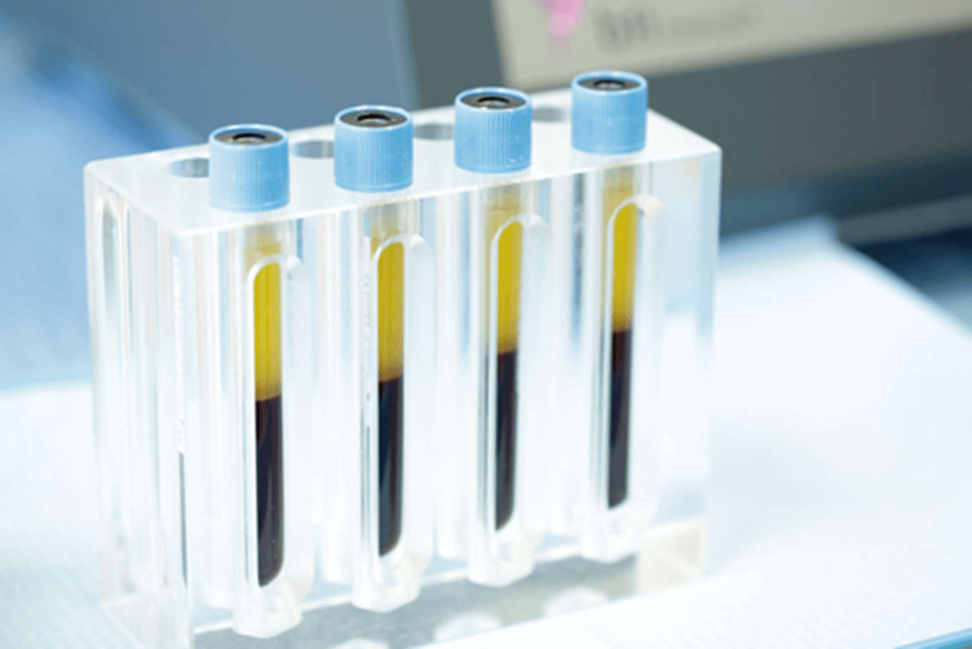 血液の分離処理